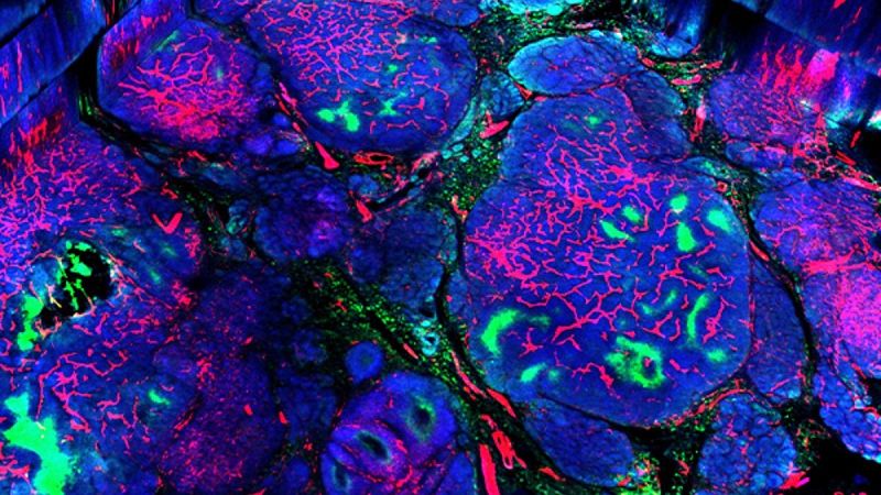 Científicos del CSIC descubren una nueva diana para el tratamiento del cáncer de mama