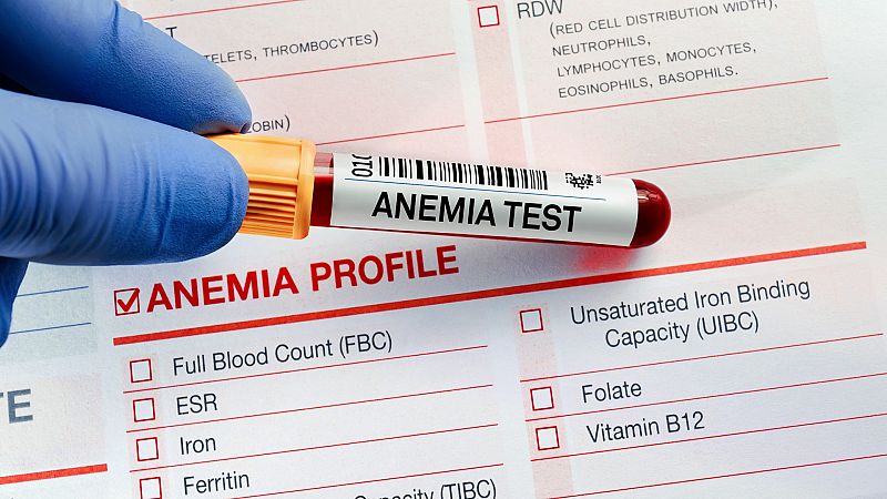 ¿Contribuye la leche y los yogures a la anemia?