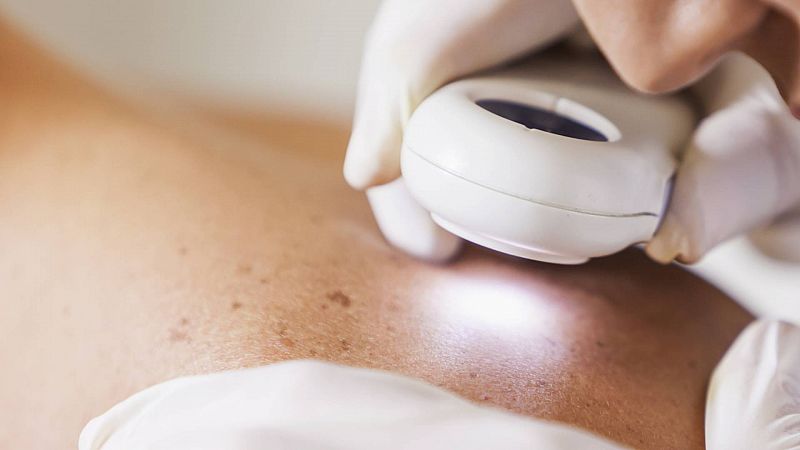 La piel: el órgano más visible y extenso de nuestro cuerpo