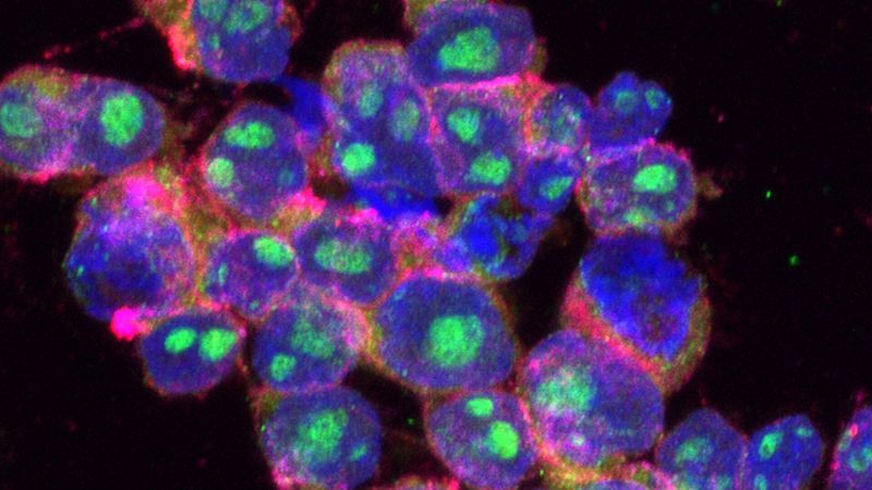 Desarrollan nanocápsulas con control remoto para amplificar localmente el efecto de la quimioterapia