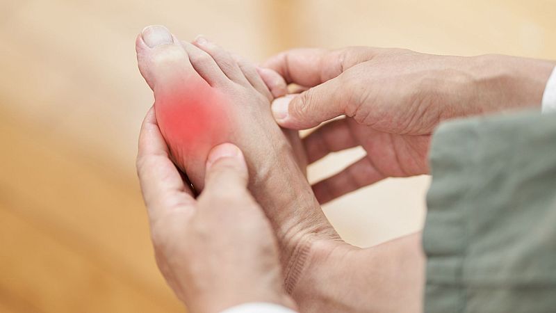 Consejos nutricionales para evitar la gota, según Aitor Sánchez