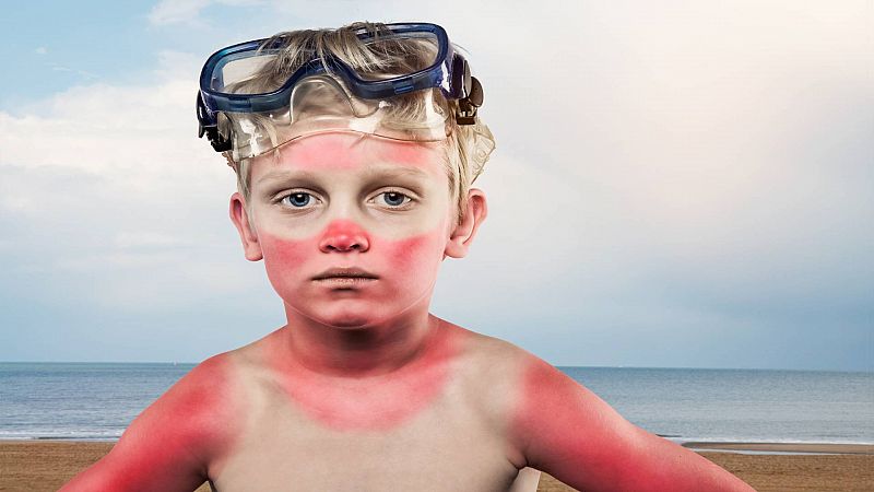 Amigos y enemigos de la piel en verano: consejos clave para cuidarnos del calor y el sudor