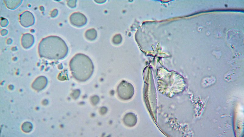 Un hombre adulto está compuesto por 36 billones de células y una mujer por 28 billones