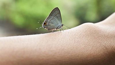 Las cuñas de RNE - Día Internacional de la Piel de Mariposa - Escuchar ahora