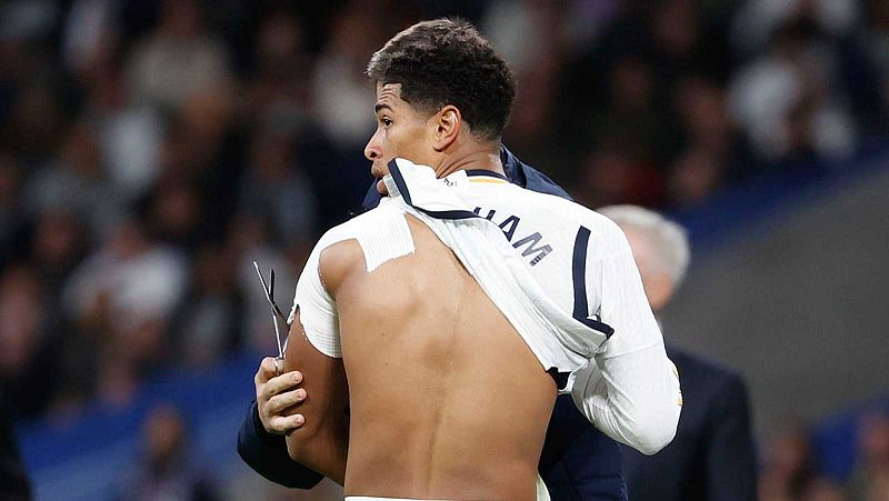 El Madrid no arriesgará con Bellingham tras confirmarse su luxación de hombro