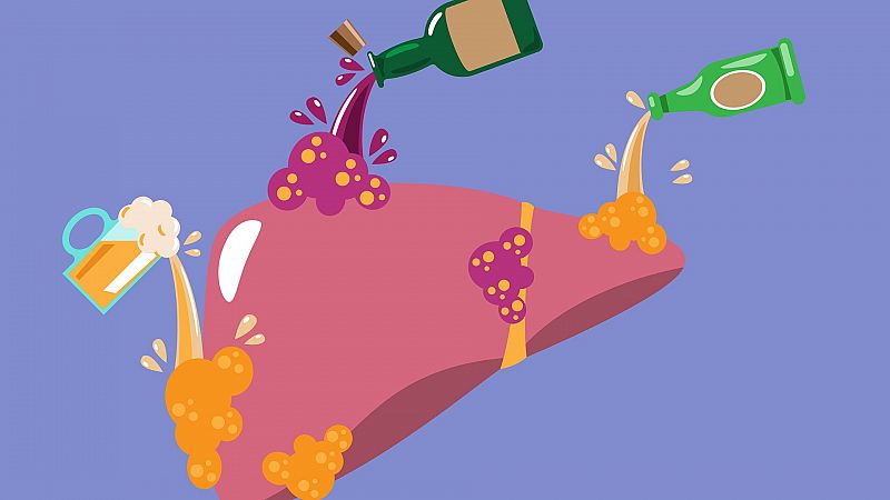 La OMS confirma la influencia del consumo de alcohol en el cáncer