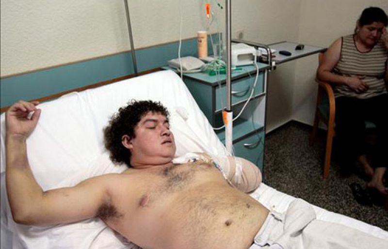 El Gobierno regulariza al trabajador ilegal boliviano que perdió el brazo