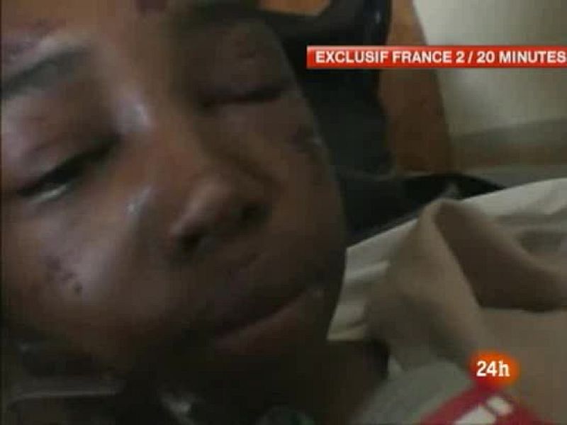 La niña, superviviente del avión de Yemenia, sufre "contusiones múltiples y quemaduras"