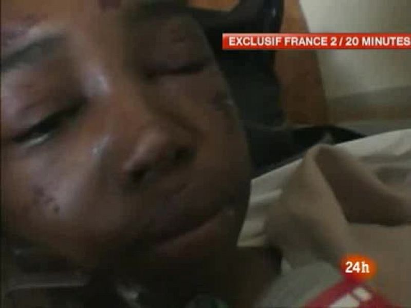 La niña, superviviente del avión de Yemenia, sufre "contusiones múltiples y quemaduras"