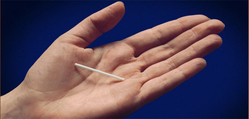 Un implante bajo la piel de la hormona gestágeno es el anticonceptivo más eficaz según un estudio