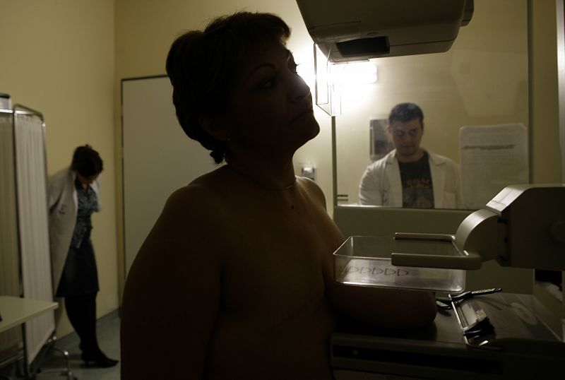 El cáncer de mama desciende entre las mujeres mayores de 45 años
