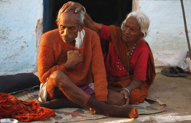 El 25º aniversario del desastre de Bhopal, marcado por las secuelas de las víctimas