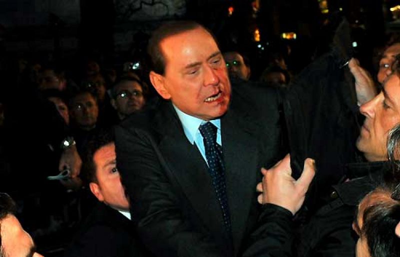 Berlusconi considera un milagro no haber sufrido daños mayores por la agresión