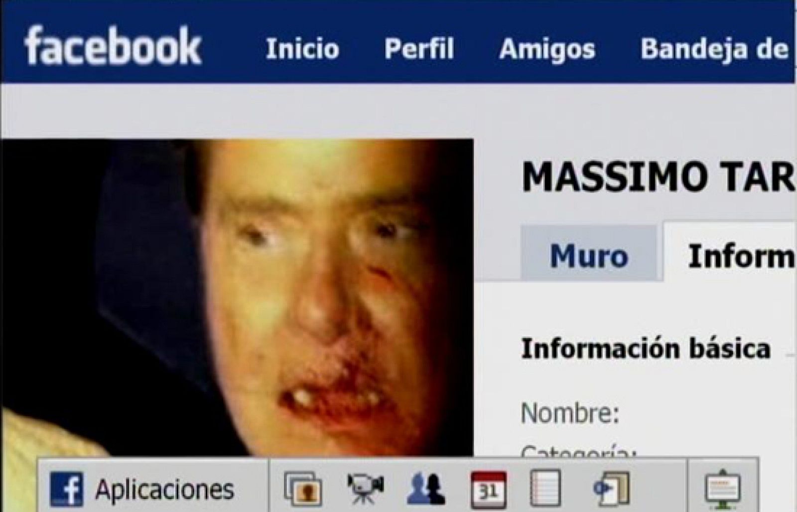 Silvio Berlusconi seguirá en el hospital hasta mañana después de la agresión del domingo | Ver