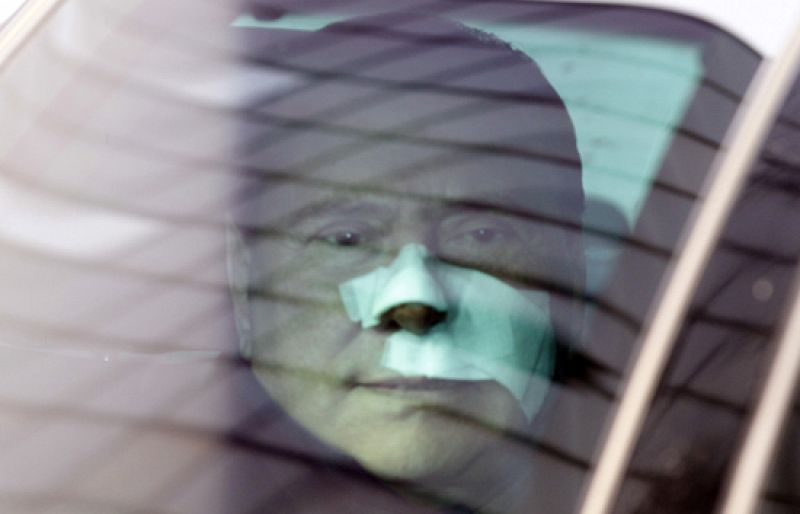 Berlusconi se tratará las heridas del rostro en una clínica estética en Suiza