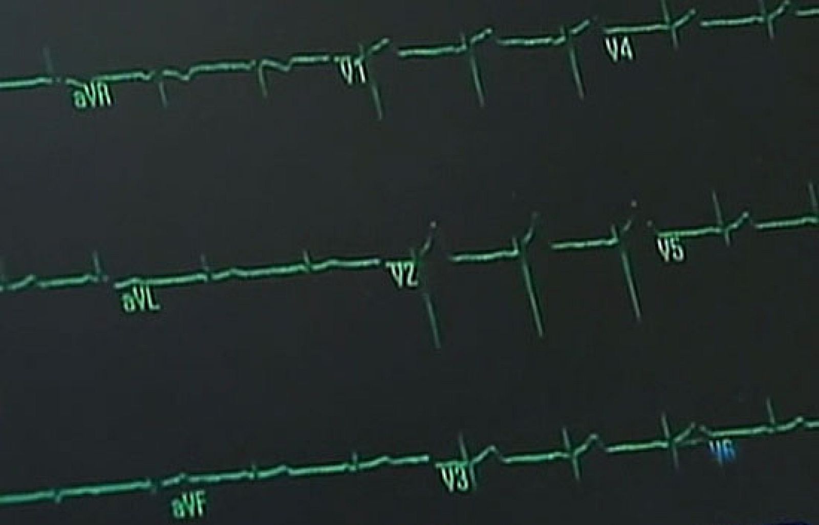 La reforma sanitaria de Obama dará cobertura médica a 32 millones de norteamericanos más | Ver
