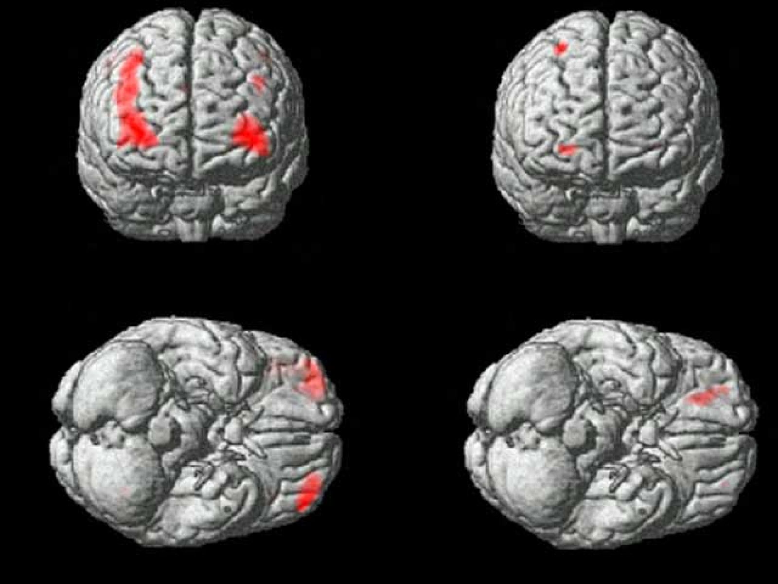 Madrid cuenta con un nuevo banco de cerebros | Ver