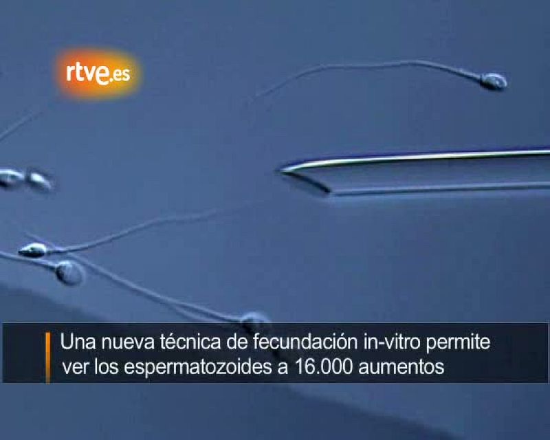 Un 'casting' de espermatozoides a 16.000 aumentos mejora las posibilidades de embarazo