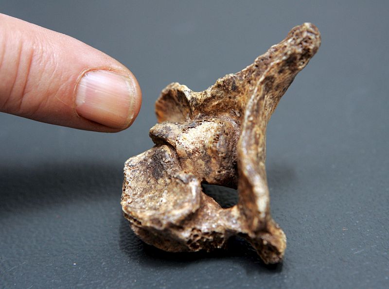 Documentan el primer hallazgo de una vértebra con cáncer en el hombre del Neolítico