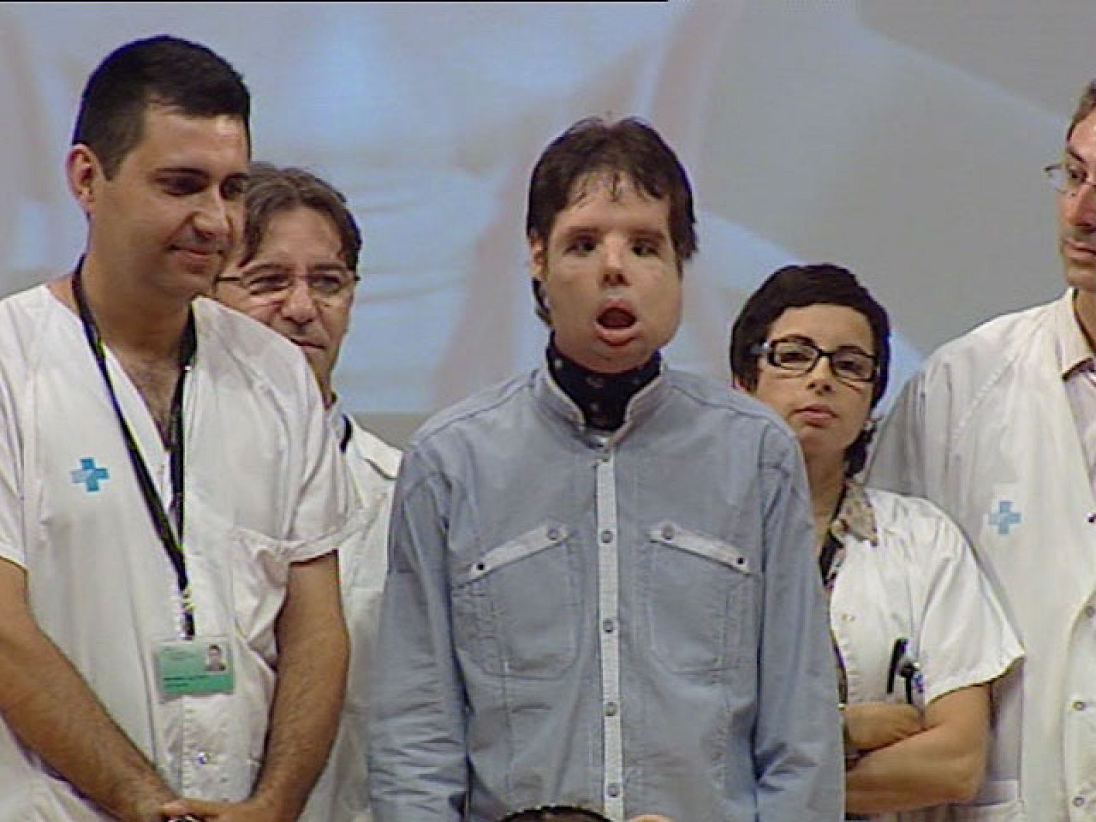 Dado de alta el primer paciente del mundo al que se le ha realizado un trasplante total de cara - Ciencia y tecnología en Rtve.es | Ver