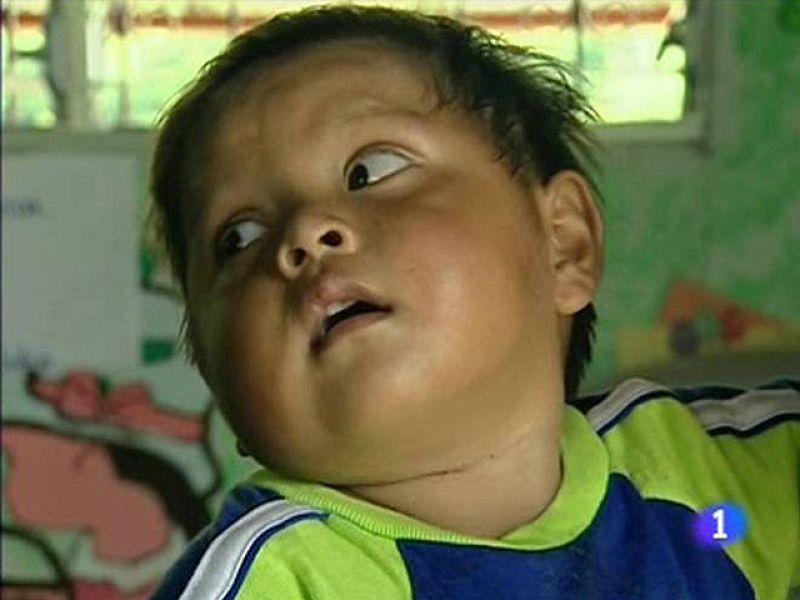 Guatemala, el país más rico entre los hambrientos