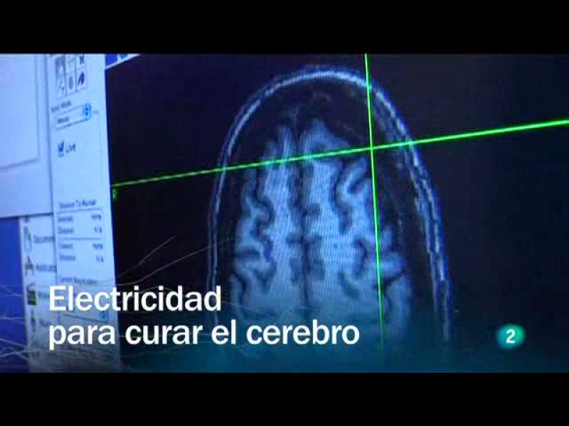 Contra el Alzheimer y el Parkinson, electrodos a la carta