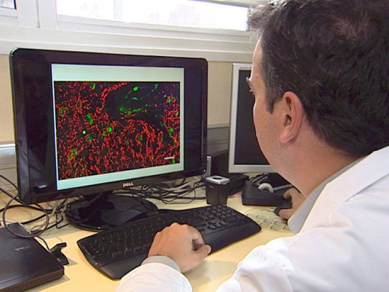 Investigadores españoles identifican las células responsables del tumor cerebral más frecuente