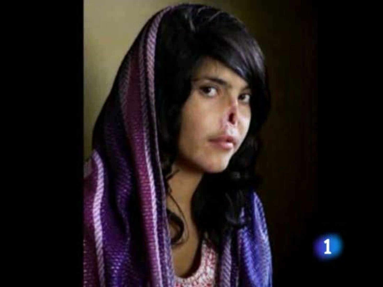 Ganadores de las mejores fotografías periodísticas del año del concurso del World Press Photo