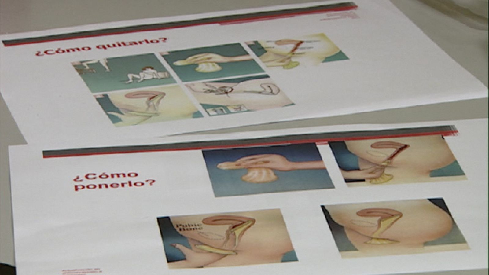 El preservativo femenino, el gran olvidado de los anticonceptivos