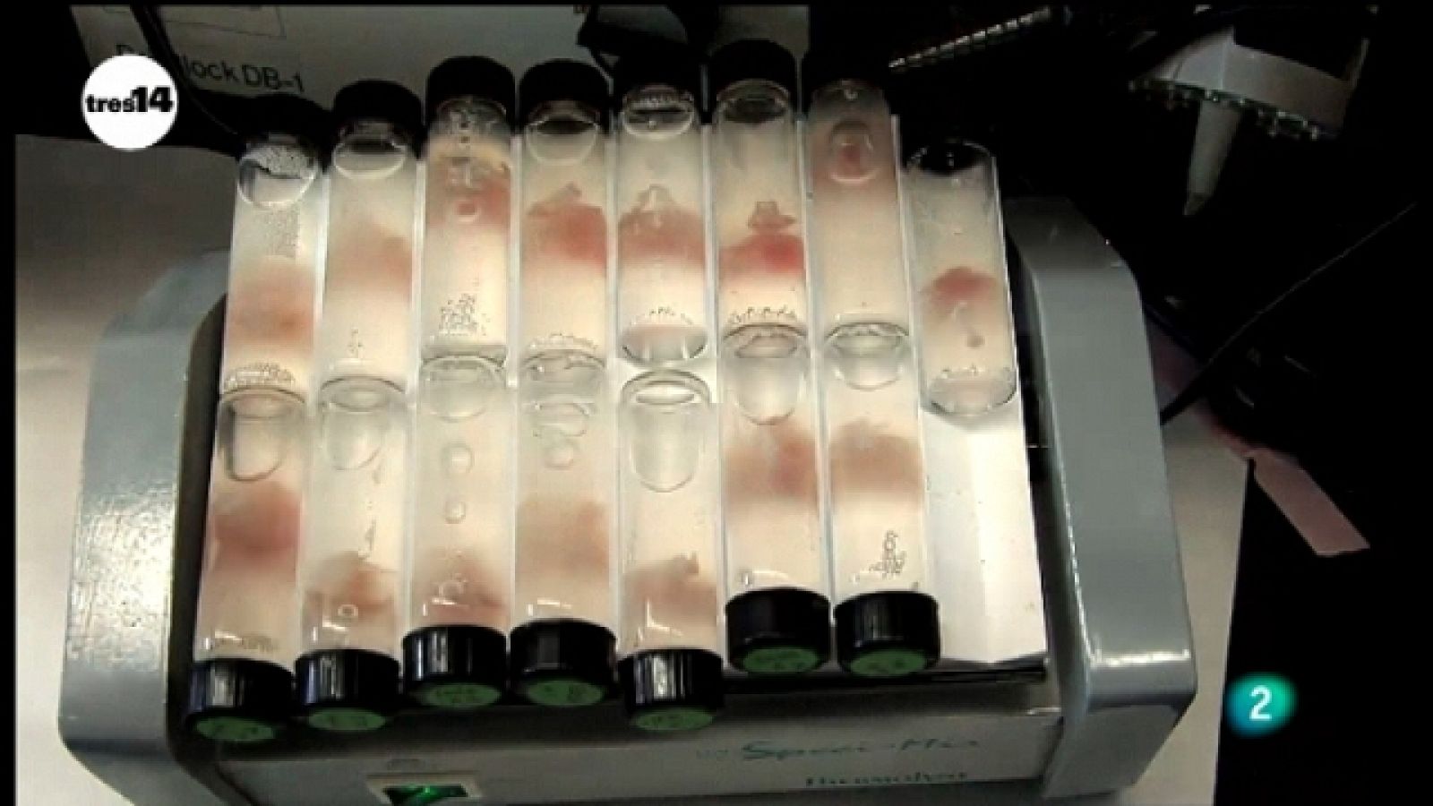 tres14 - Células madre - Ver ahora