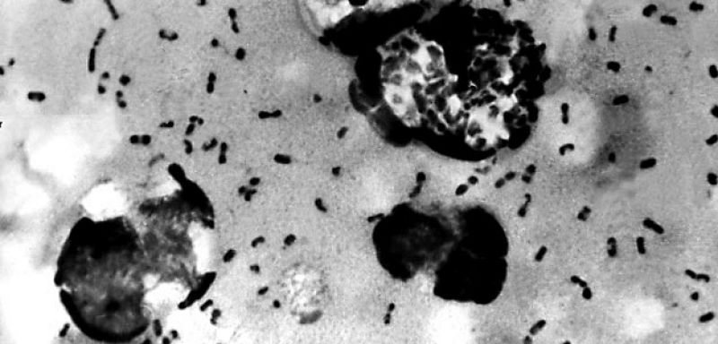 La peste bubónica del siglo XIV puede ser el origen de los brotes actuales de esta enfermedad