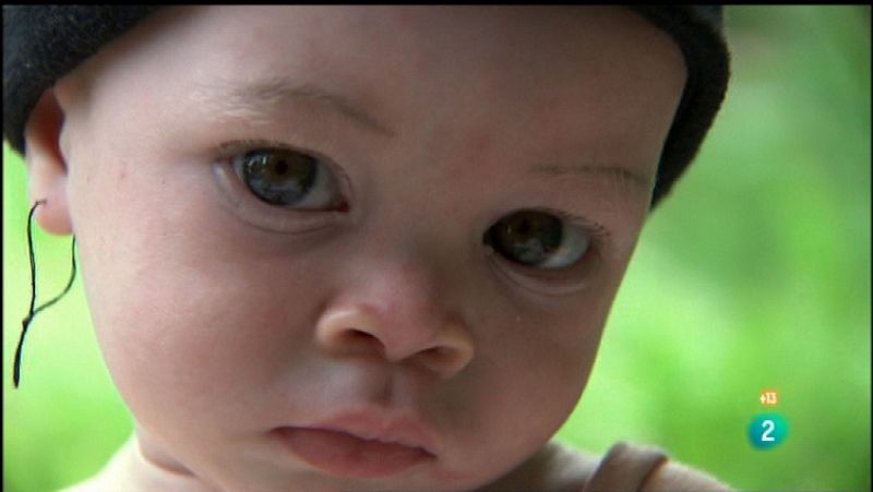 Documentos TV. "El club de los albinos"