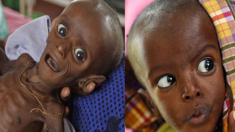 Minhaj Gedi Farah, el rostro de la esperanza en el Cuerno de África