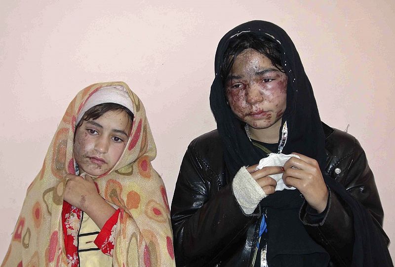 Atacada con ácido una familia afgana tras negarse a entregar a la hija mayor en matrimonio