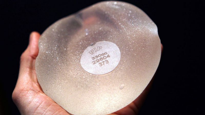 El Ministerio de Sanidad francés recomienda que se retiren miles de implantes mamarios