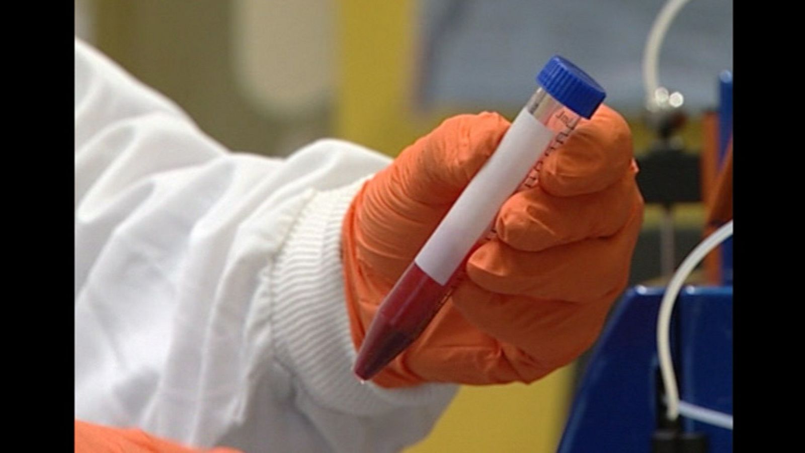 Una fundación alemana opera ilegalmente en España captando donantes de médula ósea