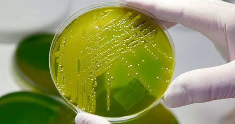 Alertan del riesgo real de quedarse sin antibióticos para bacterias multirresistentes