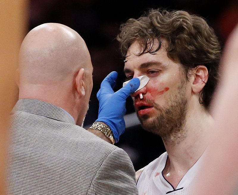 Gasol y Howard serán baja "indefinida" con los Lakers