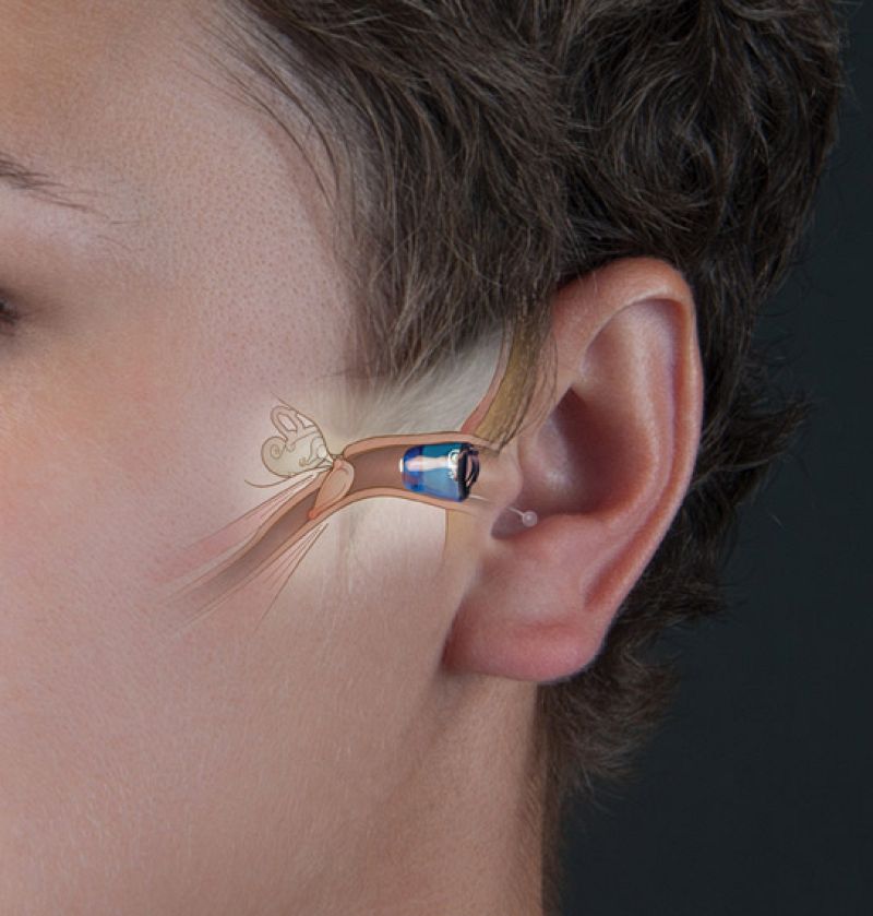 Audífonos para estar permanentemente comunicados