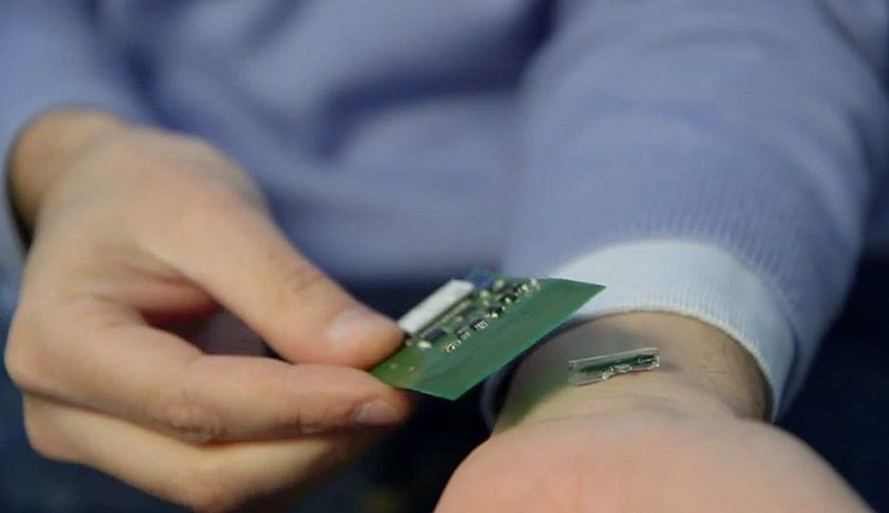 Un sensor bajo la piel que permite realizar análisis de sangre por Bluetooth