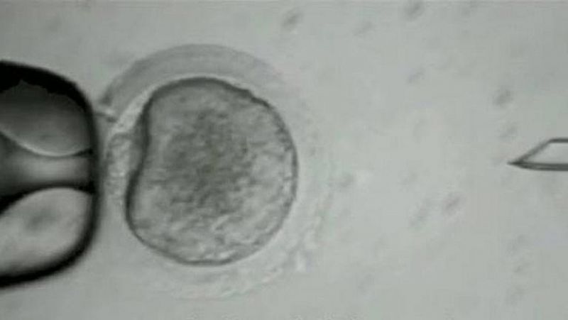 Investigadores de EE.UU. logran convertir células de piel humana en células madre embrionarias