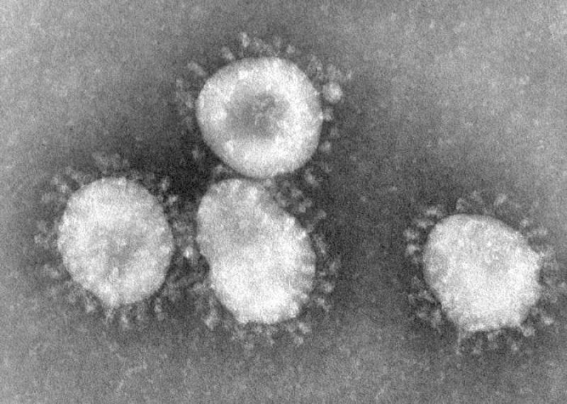 Muere un paciente en Arabia Saudí por el nuevo coronavirus