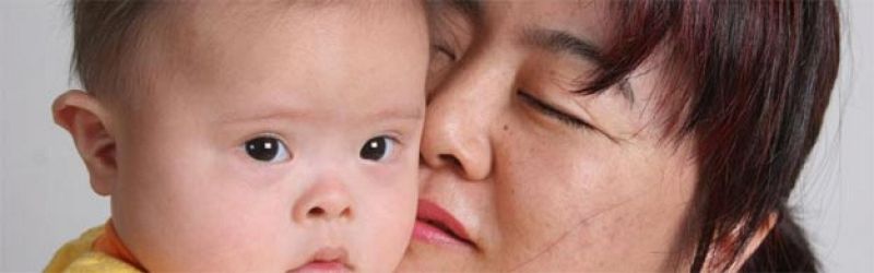 La introducción de un gen en células in vitro podría corregir el síndrome de Down