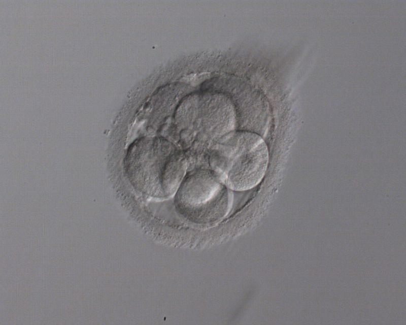 Sanidad propone que la reproducción asistida se limite a la infertilidad en la cartera básica