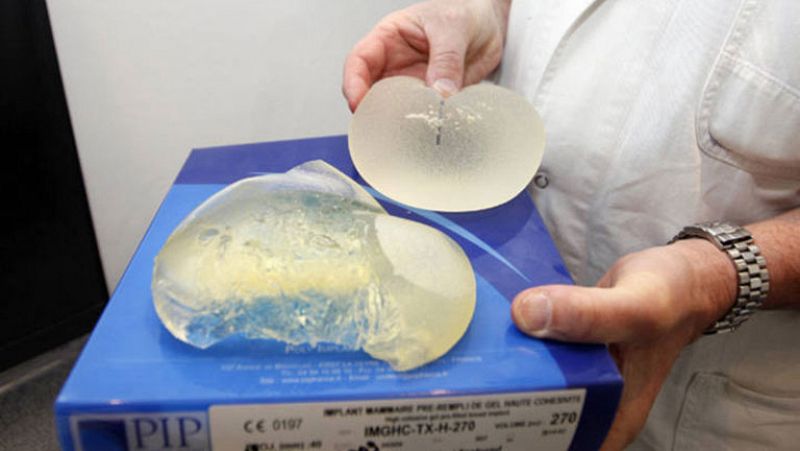 Sanidad recomienda retirar las prótesis mamarias PIP de forma preventiva pero sin urgencia