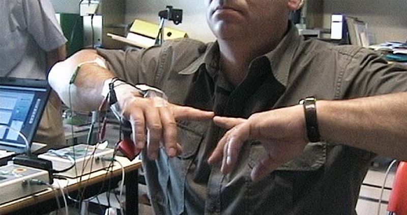 Científicos del CSIC desarrollan dispositivos que ayudan a reducir temblores motores