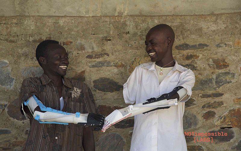 Prótesis hechas con impresoras 3D para las víctimas de la guerra en Sudán