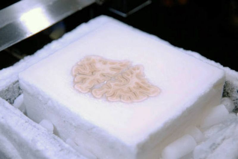 Crean un mapa en 3D de un cerebro amnésico para estudiar la memoria