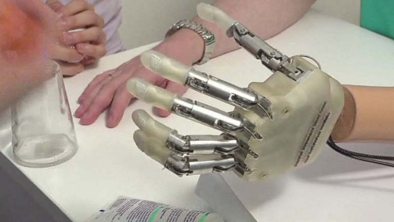 Una mano biónica permite a un paciente volver a sentir los objetos y las sensaciones