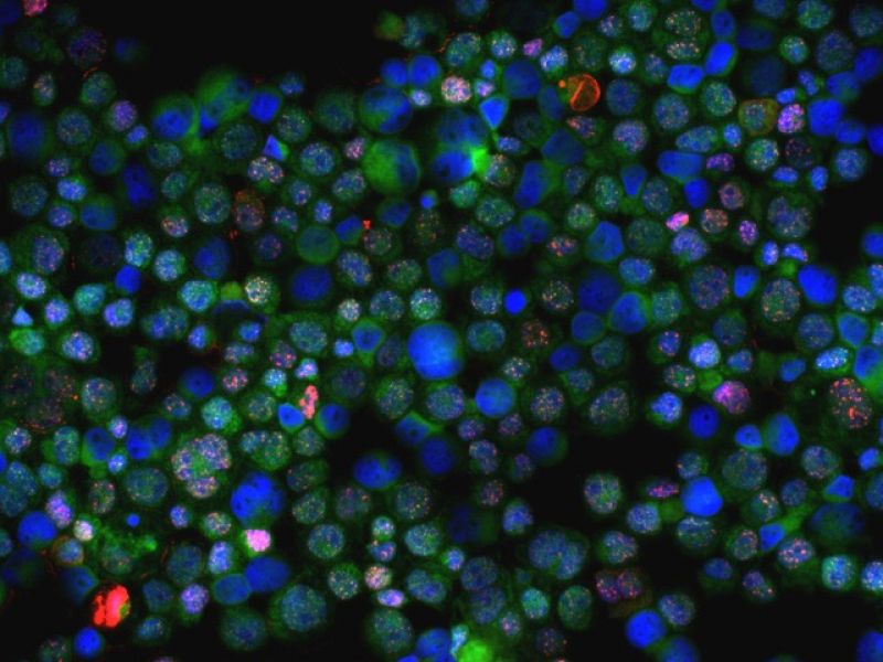 Descubren dos nuevos genes que modifican el riesgo de padecer cáncer de mama y ovario